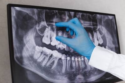oral diagnoz