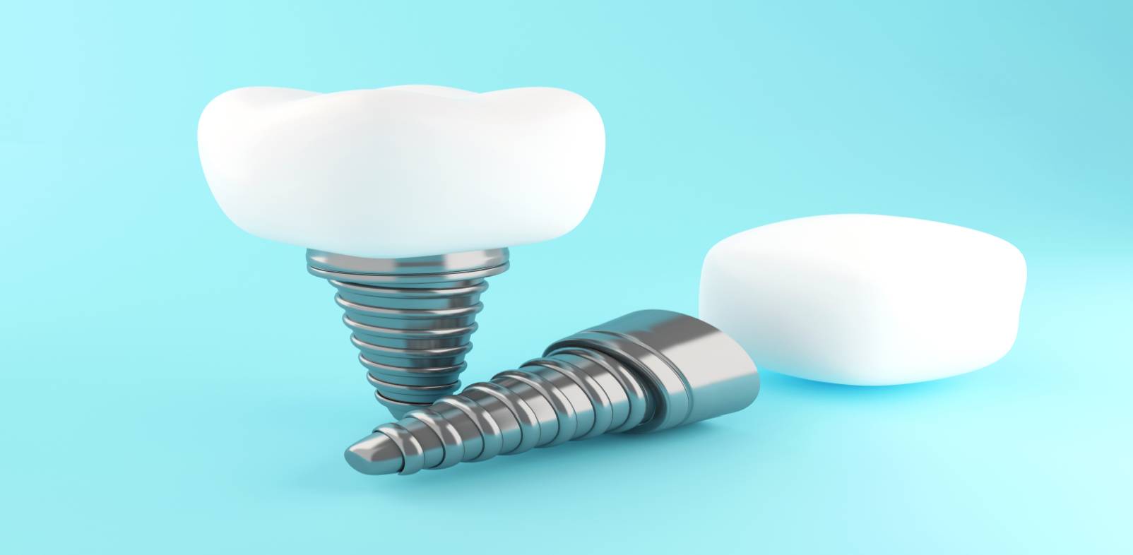 implant uygulamaları