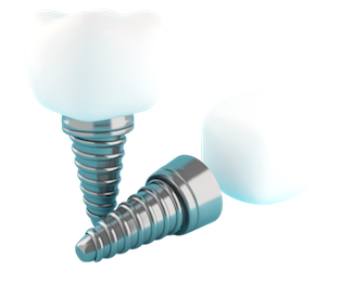 implant